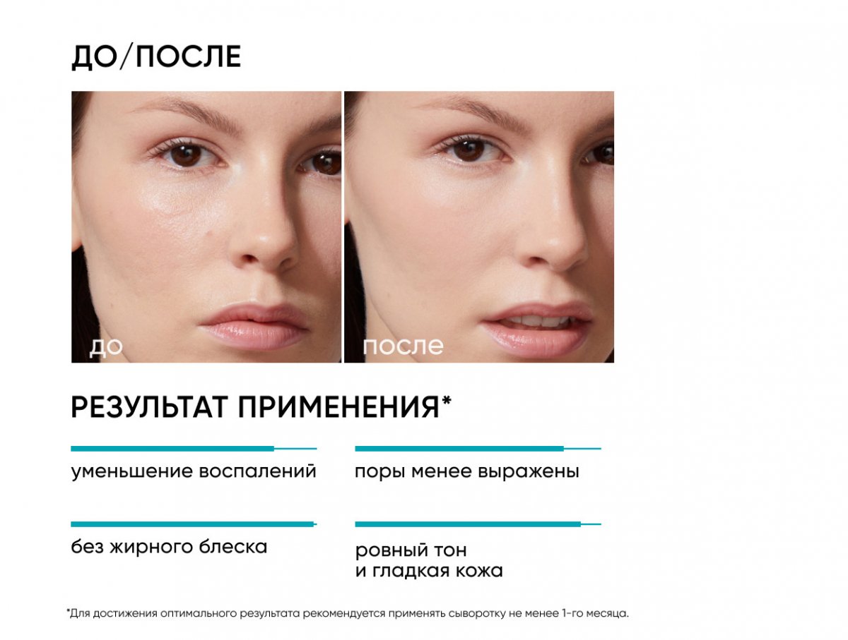 Себорегулирующая сыворотка-концентрат с ниацинамидом Rest Your Sebum / Rest Your Sebum Booster Serum