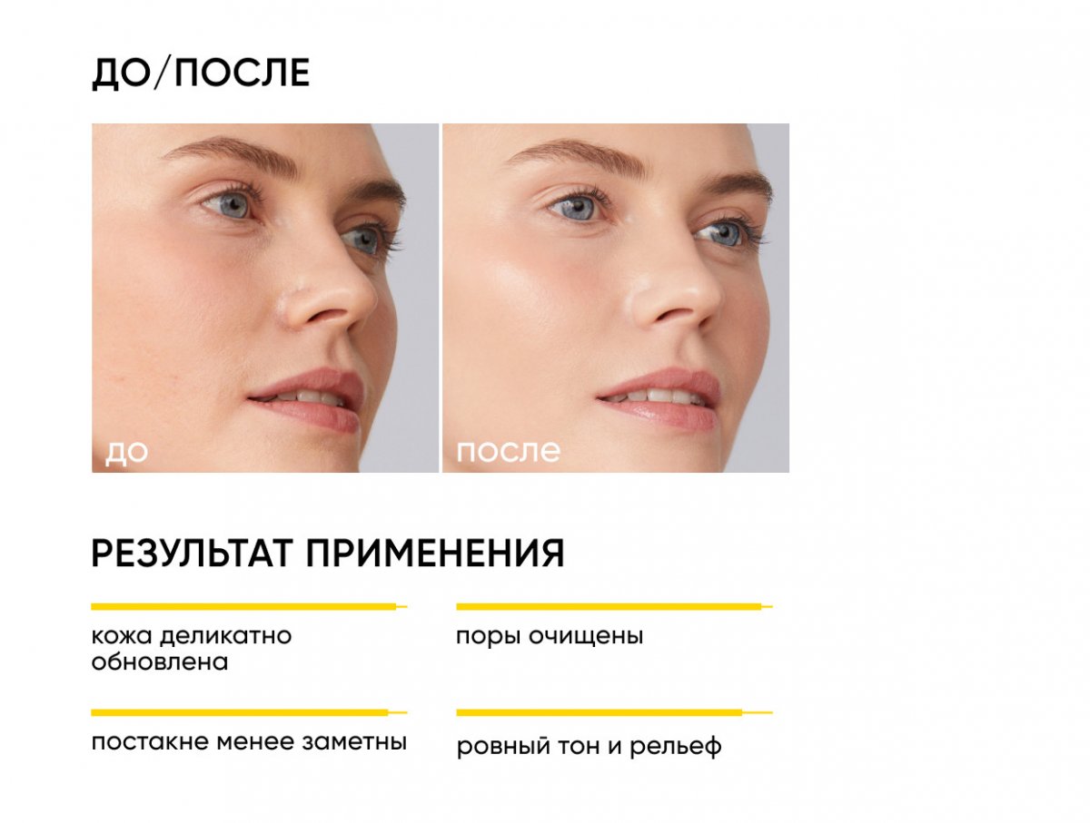 Очищающий гель для умывания с кислотами Soft Renew / Soft Renew Cleansing Gel